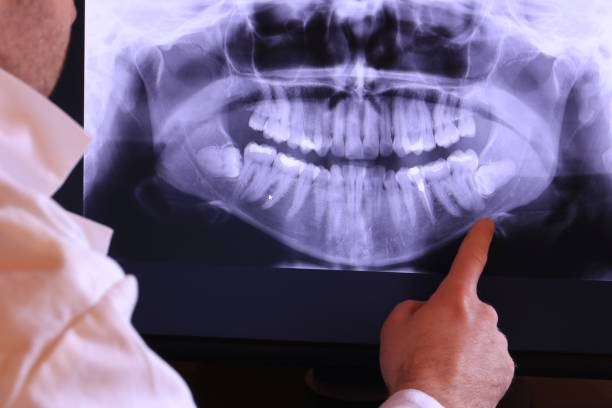 Best Affordable Emergency Dental Care  in Mccord, OK
