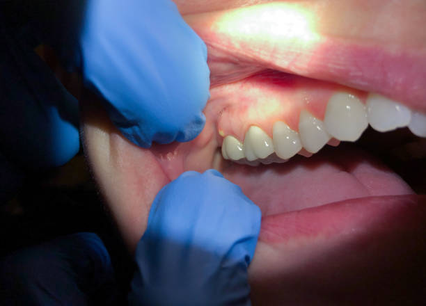 Best Knocked-Out Tooth Emergency  in Mccord, OK